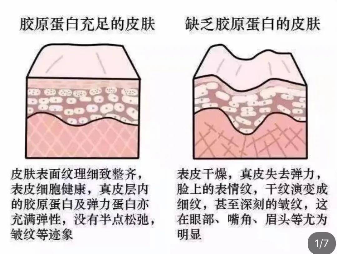 能力暨中研-远离衰老焦虑，从冬天的第一支胶原蛋白开始