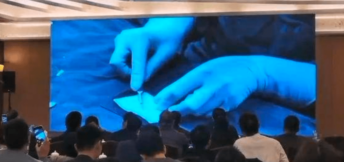 进行整形医生周建：鼻基底填充改善的不止是鼻子