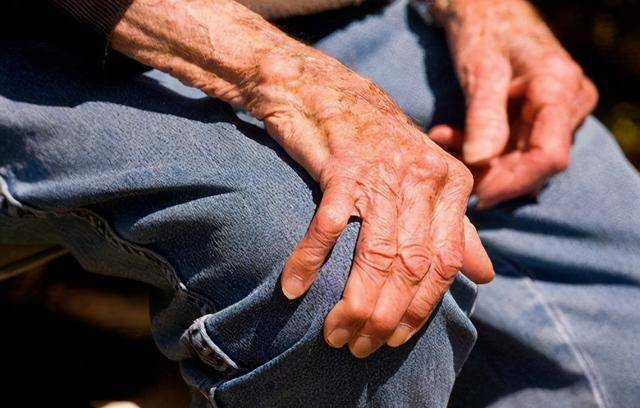 治疗|重症肌无力会影响生命吗?