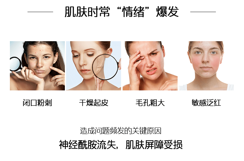 英树安抚肌肤“坏情绪” 试试英树神经酰胺舒妍细致系列