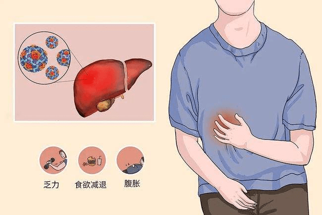 功能|肝腹水的这4大误区，你踩了几个？