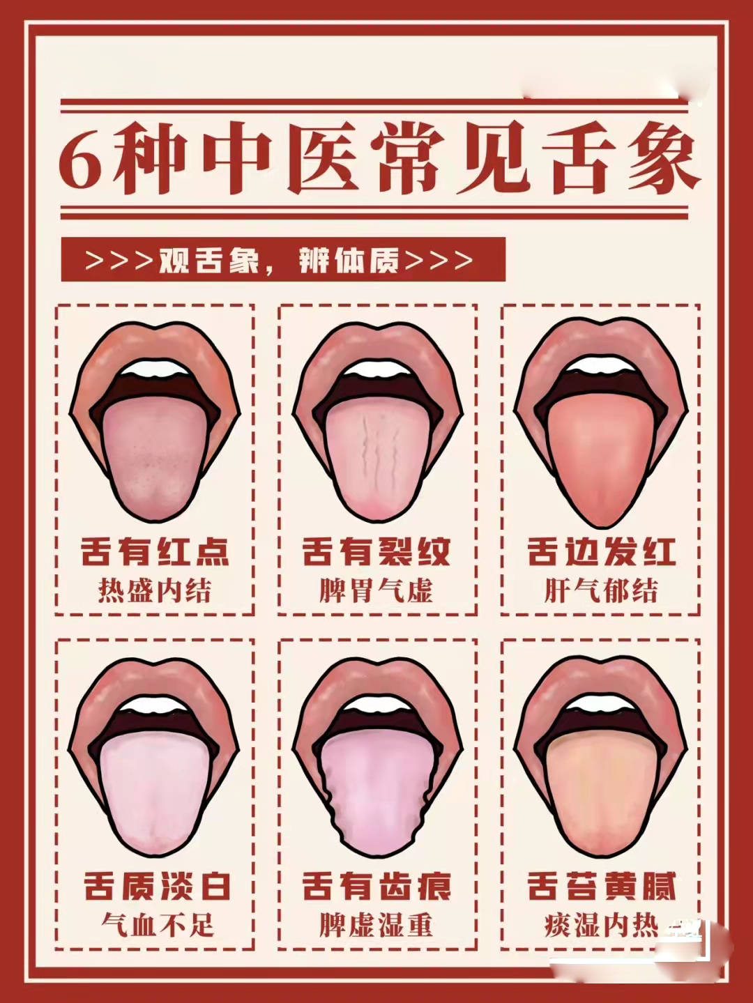 抖音舌诊哥：舌诊知健康，教你学会看舌象系列三十八 - 知乎