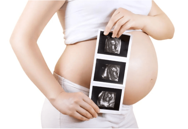 体重|长沙丽人妇产医院：孕期胎儿“懒”得动？或许和妈妈你这四个行为有关！