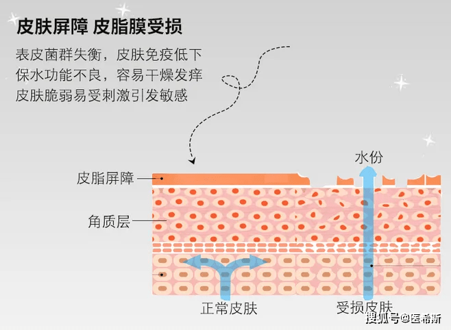 护肤品我的脸好红好痛...！还有救吗！！？