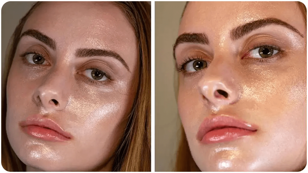 敏感肌脸上出油怎么回事混油皮敏感肌怎么护肤