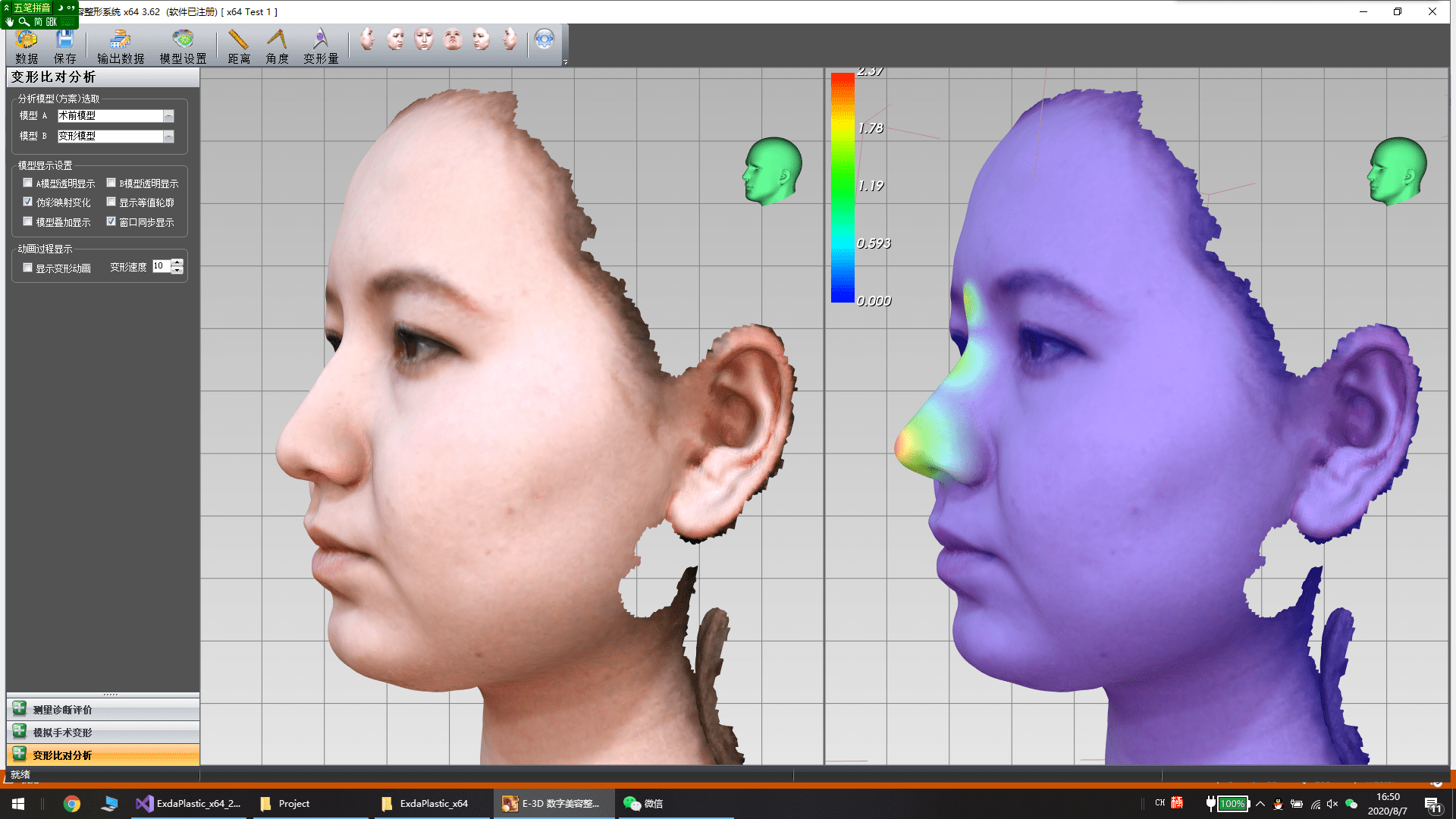 2,鼻整形与假体定制可读取ct和mri扫描图像数据,具有高质量的实时体