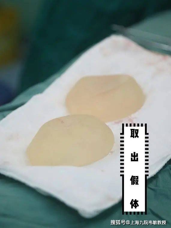 根据隆胸时的切口如在腋窝下方或乳房外侧或乳房下皱壁切开相应大小的