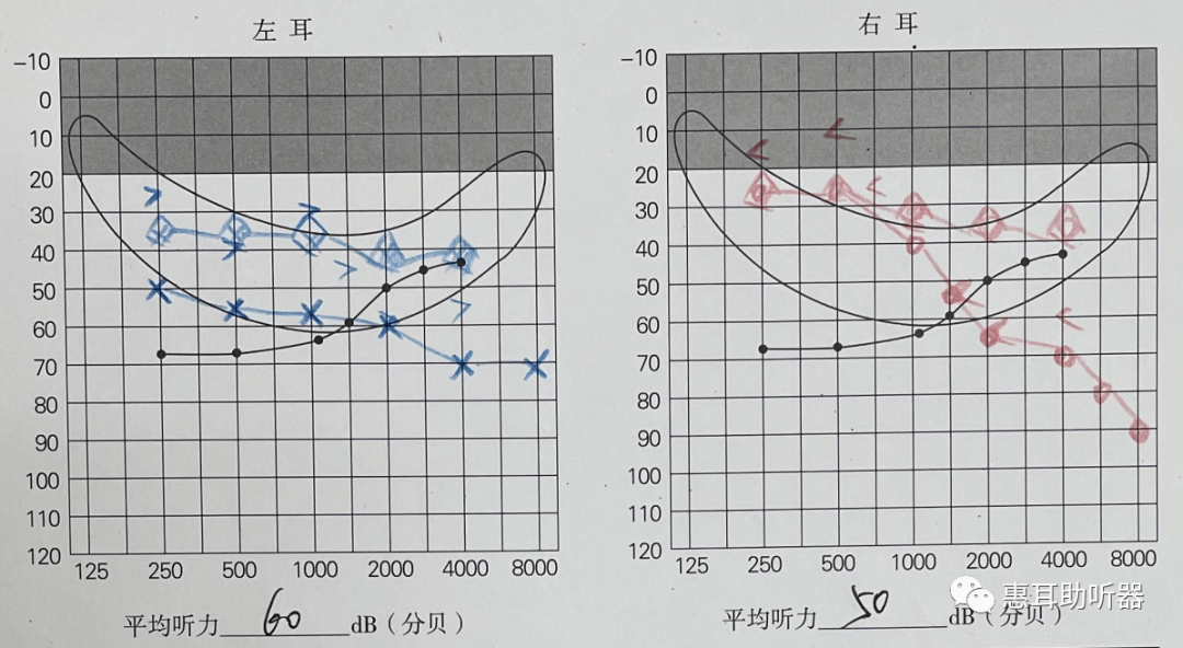 充电式助听器