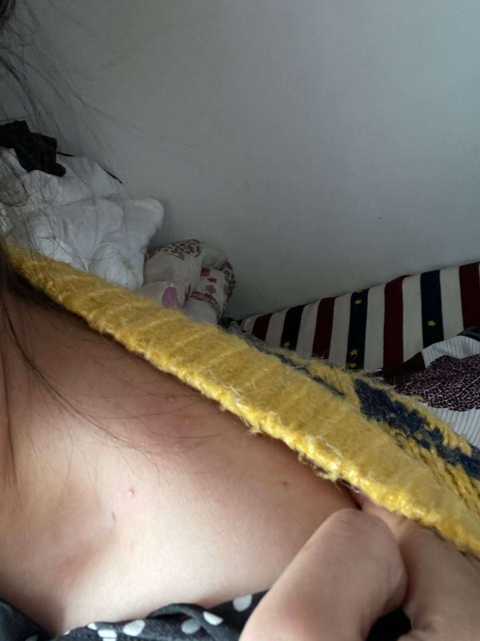 原创女性胸前和后背长痘痘是什么原因