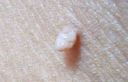 看完要记牢记_皮肤_牛程_毛周