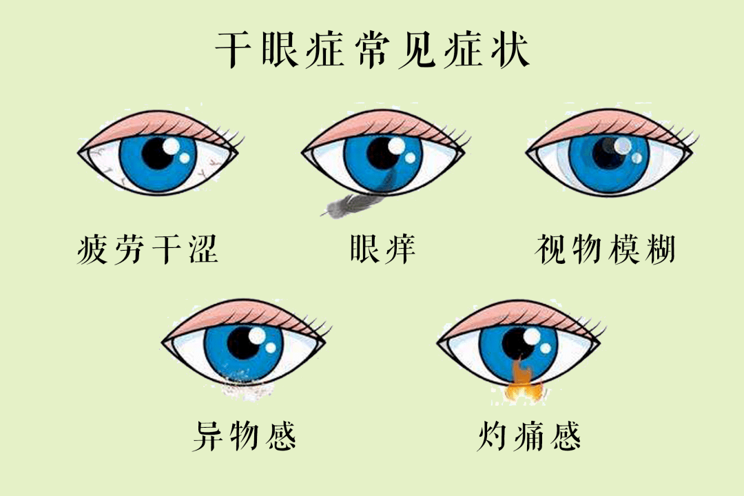 较严重的患者眼睛会出现红肿,充血,角膜上皮破皮而有丝状物粘附,长期