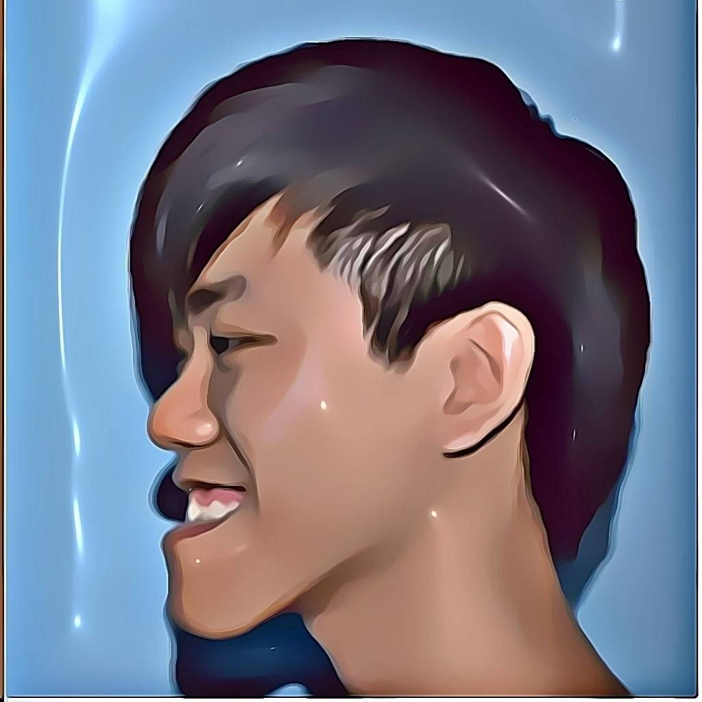 地包天严重脸型图片矫正后变化有多大?_咬合_综合_侯振杰