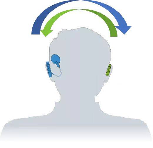 北京301医院人工耳蜗双模式救助项目正式启动重度听力损失人群福音