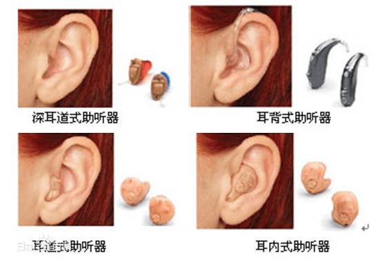 炎陵万聪助听器今日分享：助听器（辅助听力东西）