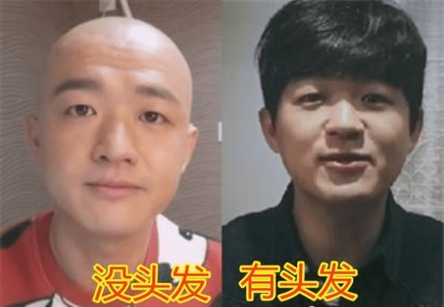 原创没头发vs有头发郭德纲精神包贝尔呆萌第一的他帅得掉渣