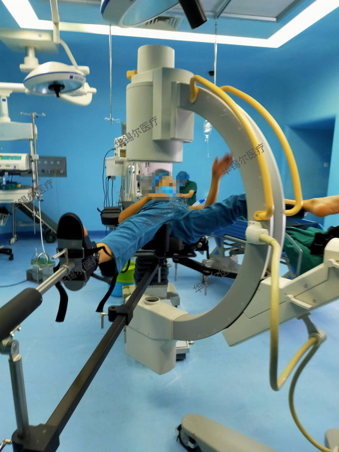 飞利浦c型臂手术床_透视_效果_匹配