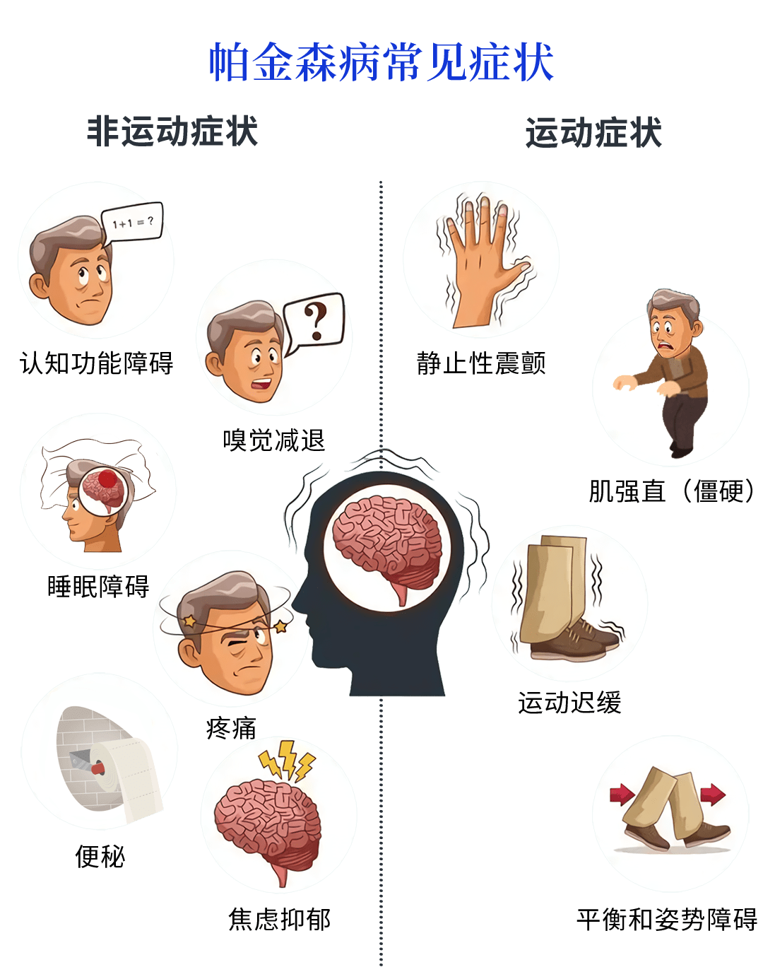 帕金森病黑质图片