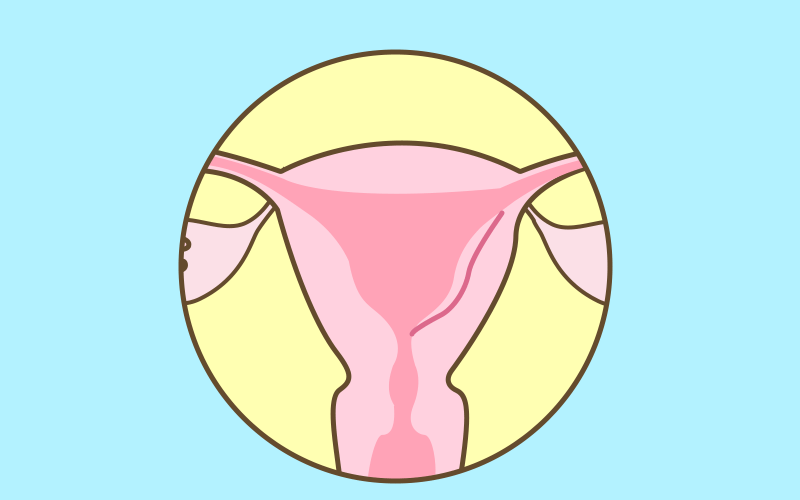 此外,子宫纵隔,宫腔粘连,内膜息肉,粘膜下子宫肌瘤等这些子宫病变,也