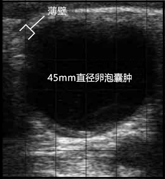 牛卵泡囊肿b超图超声经济学超声波对牛生殖管理计划的经济价值取决于