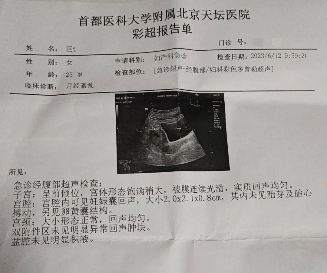 怀孕2月B超图片图片