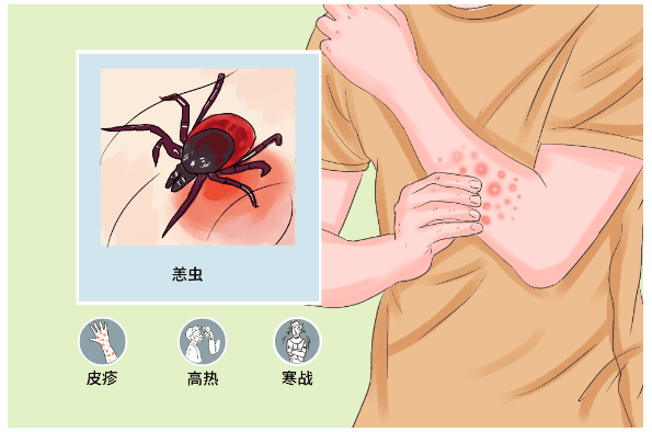 小型啮齿类动物,包括多种鼠类,可长期无症状携带恙虫病东方体,恙螨