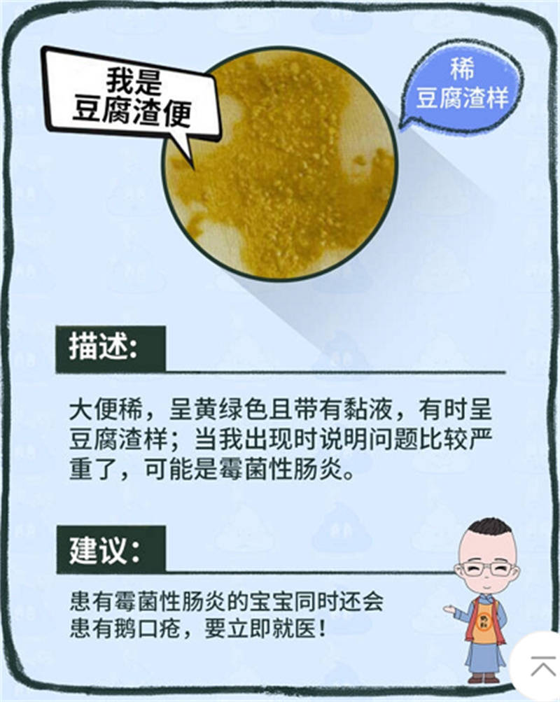 徐州市儿童医院科普:宝宝的各种便便全解_大便_绿色_孩子