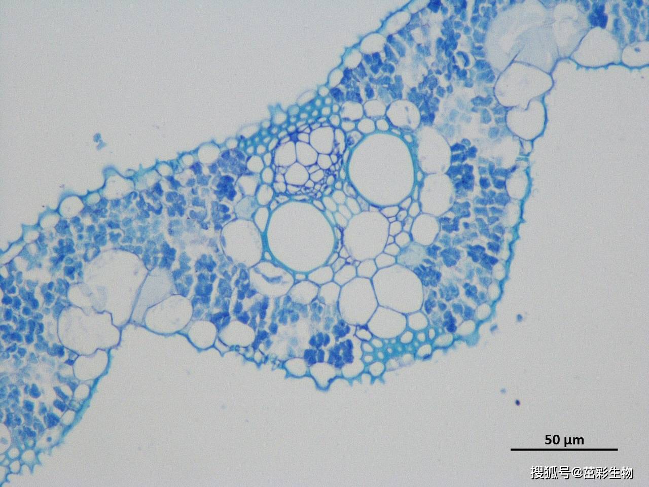 甲苯胺蓝染细胞核图片