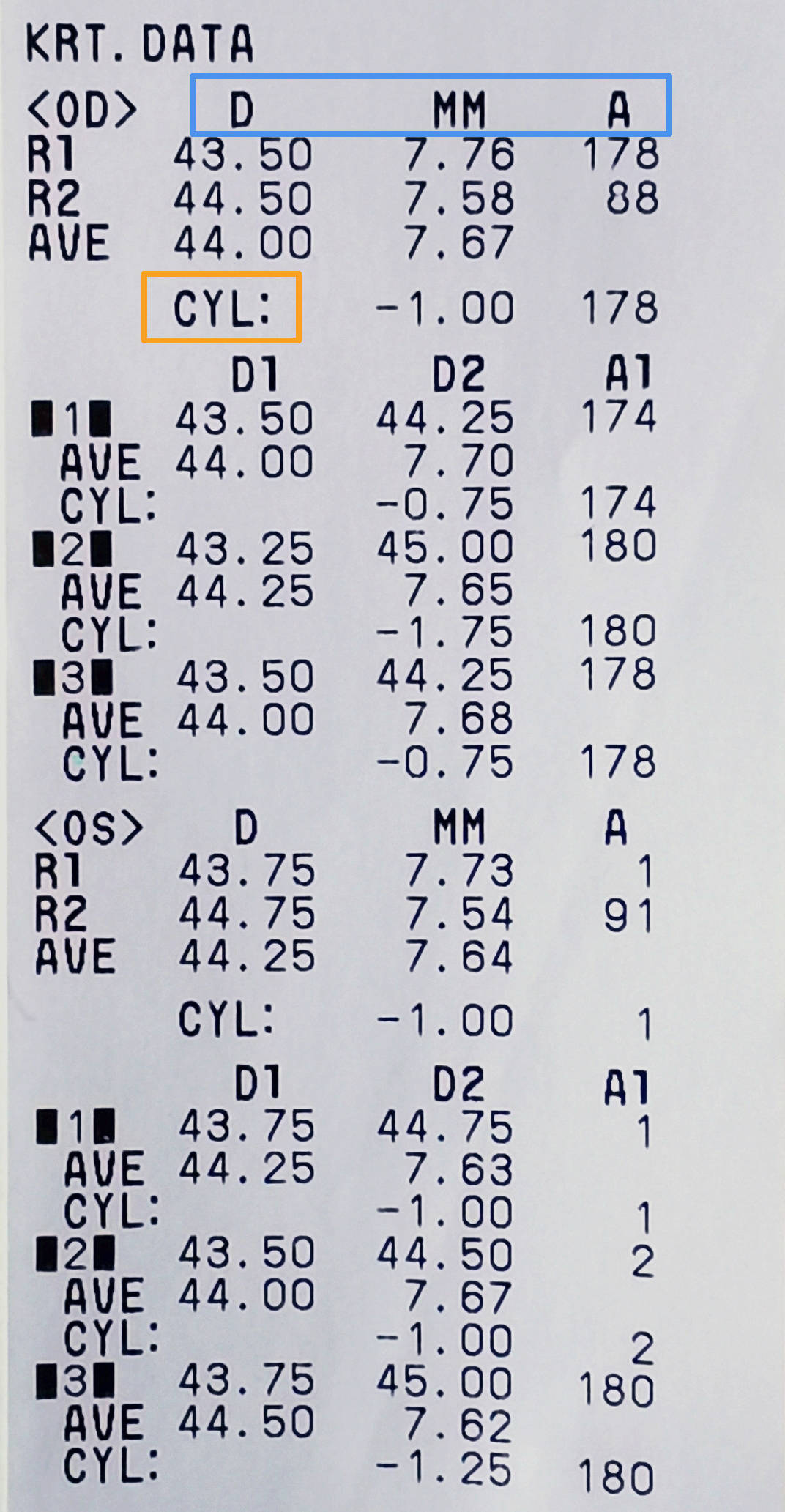 手把手教你看懂电脑验光检查单,建议收藏_散光_角膜_情况