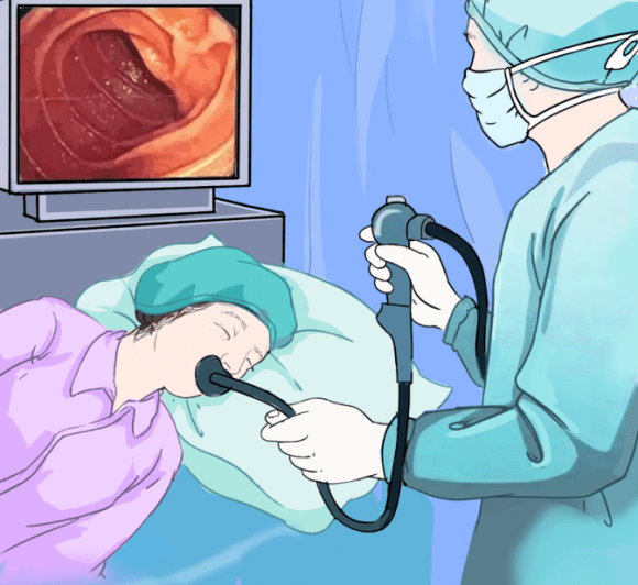 年轻人有必要做胃肠镜吗?_检查_进行_疾病