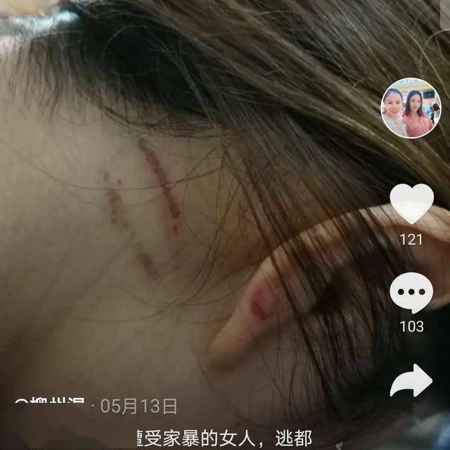 丈夫稱妻子出軌對其家暴並限制自由妻子不想離婚拍抖音求救