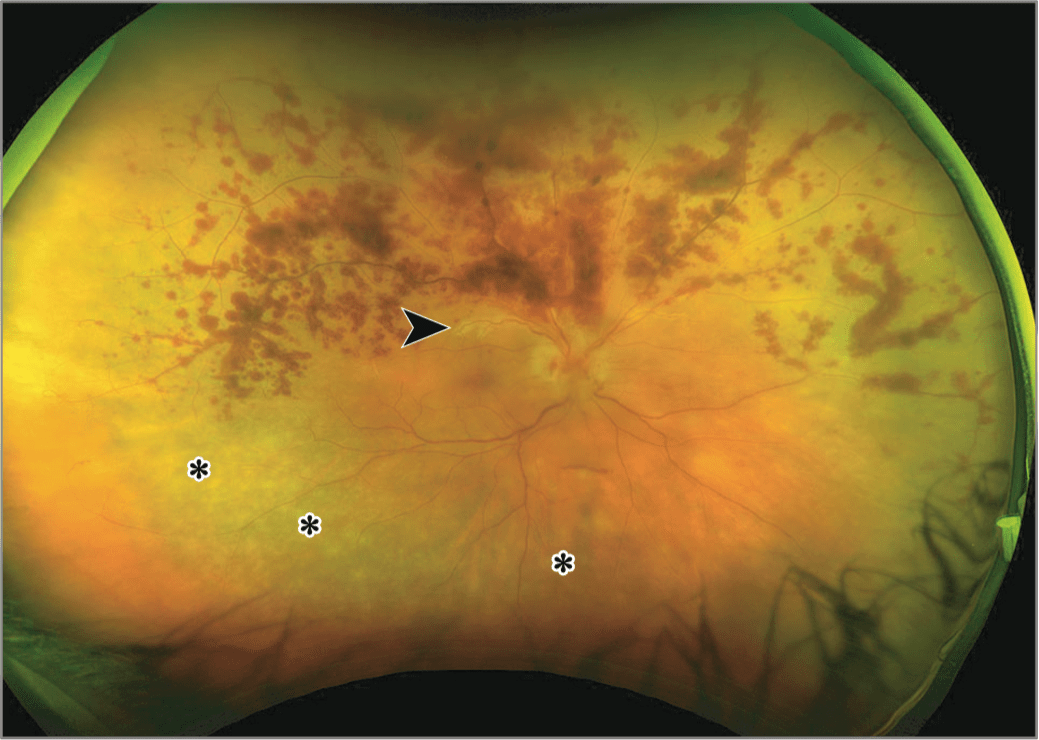 【惟视诊室】一半"火树",一半"银花" | 一名中年