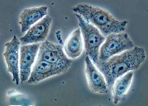 一黑人妇女病逝,细胞却挽救患儿生命,帮助人类实现首次细胞克隆