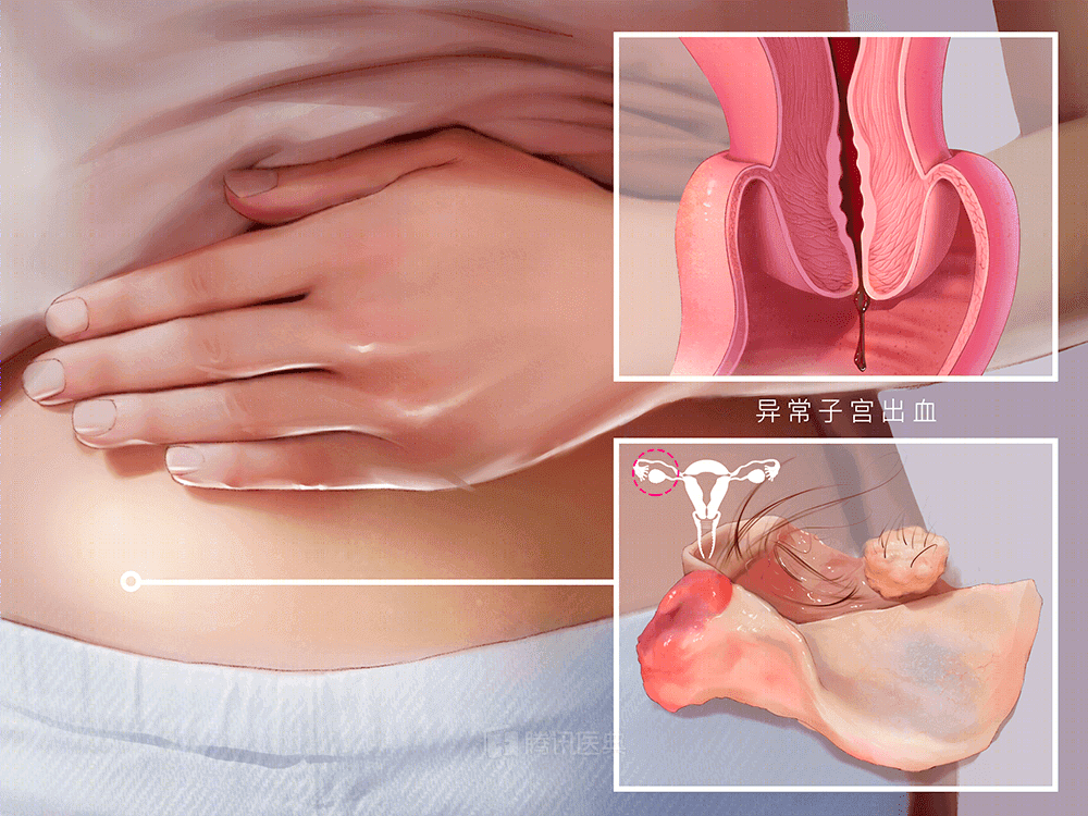 怀孕8月广东19岁女生肚里掏出6斤娃和30多斤