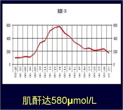 明顯治療方案調整61 繼續雙抗血小板,抗凝,利多卡因泵入治療61