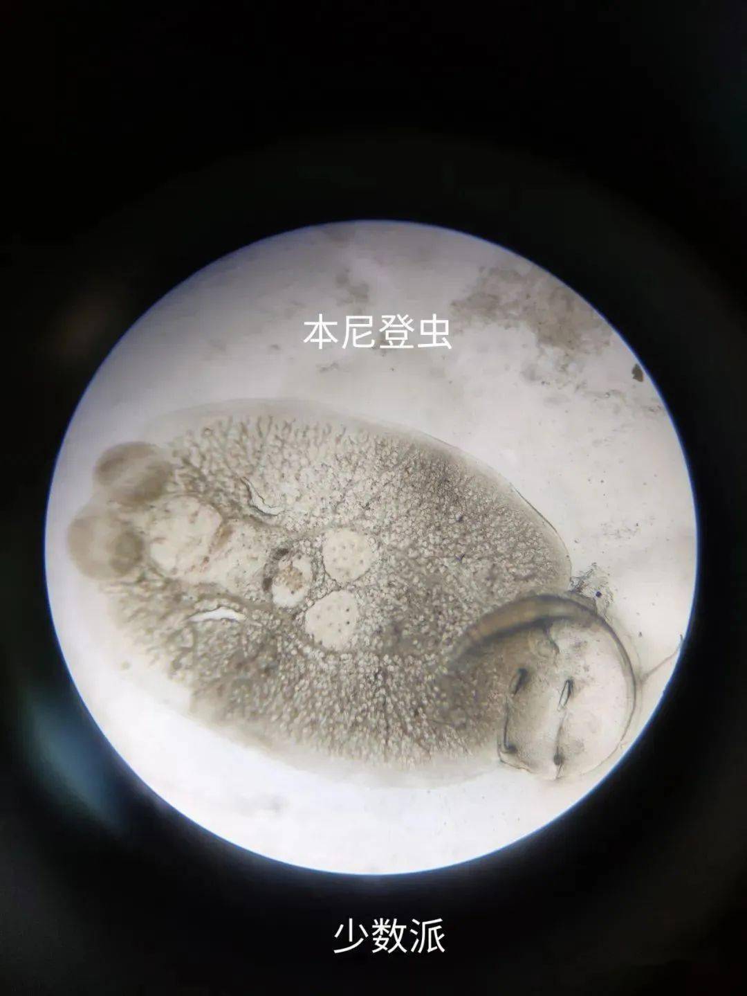 白芝麻虫挠伤之后,往往导致皮肤溃烂,细菌迅速感染,传播,有些未被挠伤