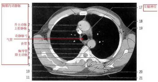 详尽的胸部ct影像示意图