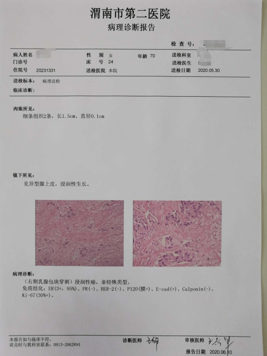 渭南市第二医院病理科成功开展免疫组化染色与诊断技术