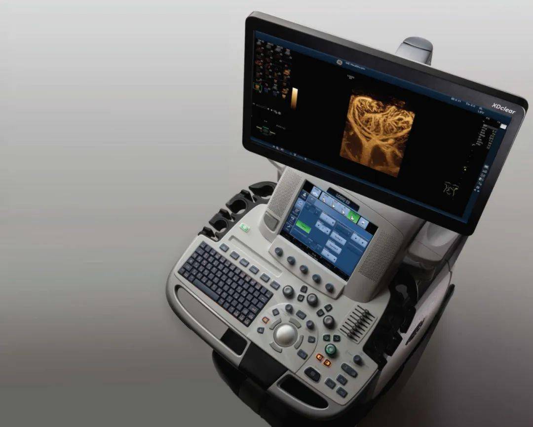 诸城中医医院超声科又增添新武器gelogiqe9型超声诊断仪