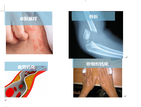 血液透析患者高磷那些事儿