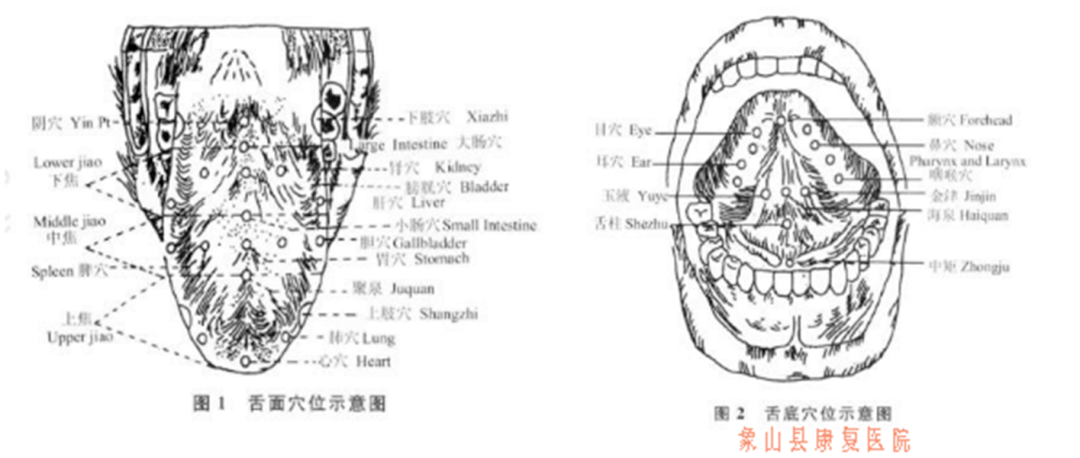 針刺,灸法,針刺又包括舌針,頭針,體針等;西醫治療多采用語言康復和