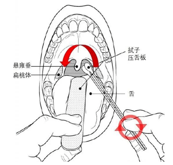 咽拭子采集部位解剖图图片