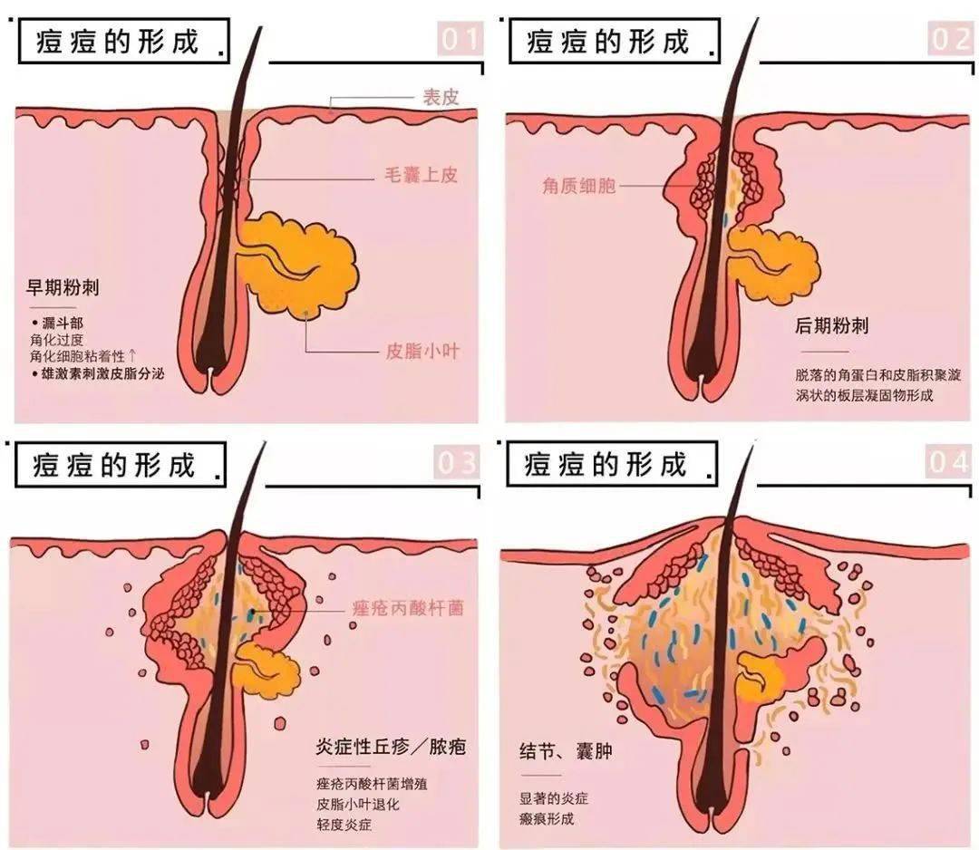 男生下面长痘痘原因图片