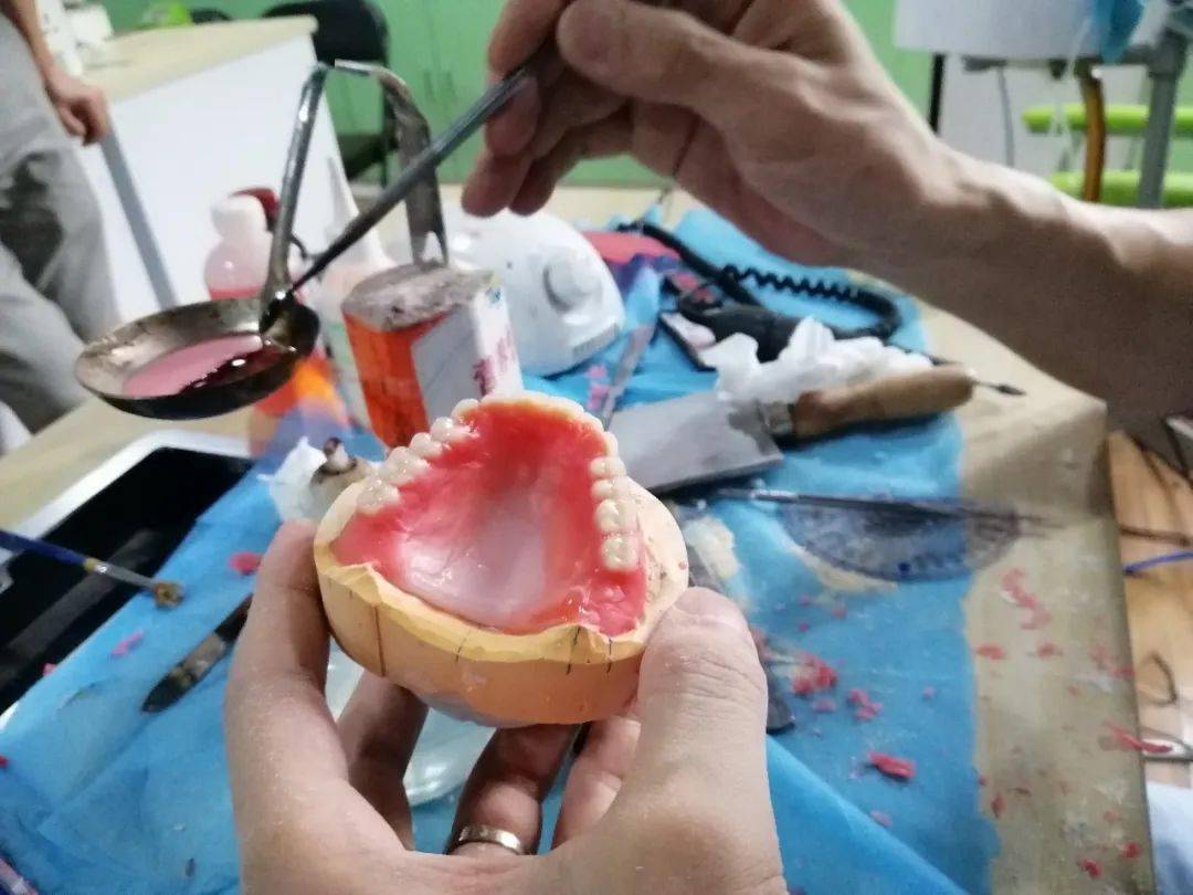 倾尽匠心方尽完美欣乐美联合摩尔口腔圆满举办全口义齿制作标准技能