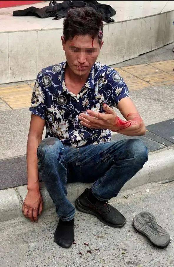 下午江油发生一起伤害案件