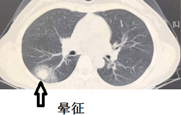 月晕征图片