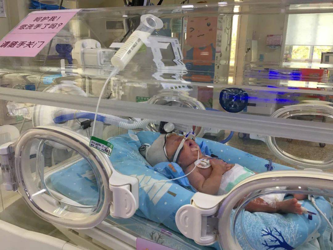 出生时仅巴掌大体重1斤多顺德超早产双胞胎健康出院了