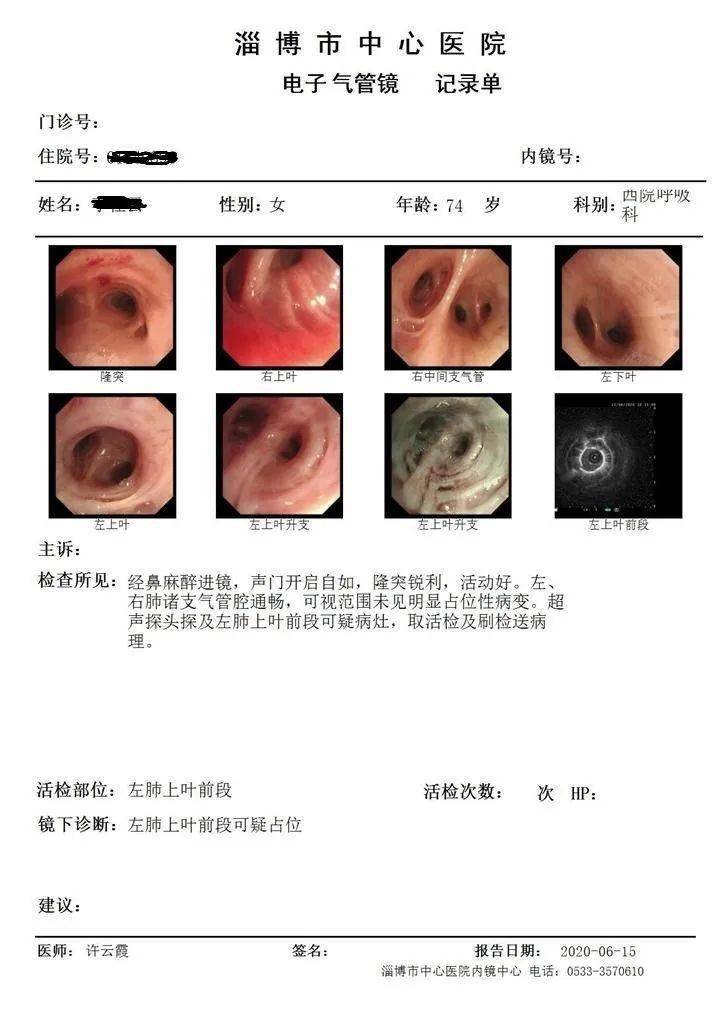 支气管镜检查地点:淄博市中心医院