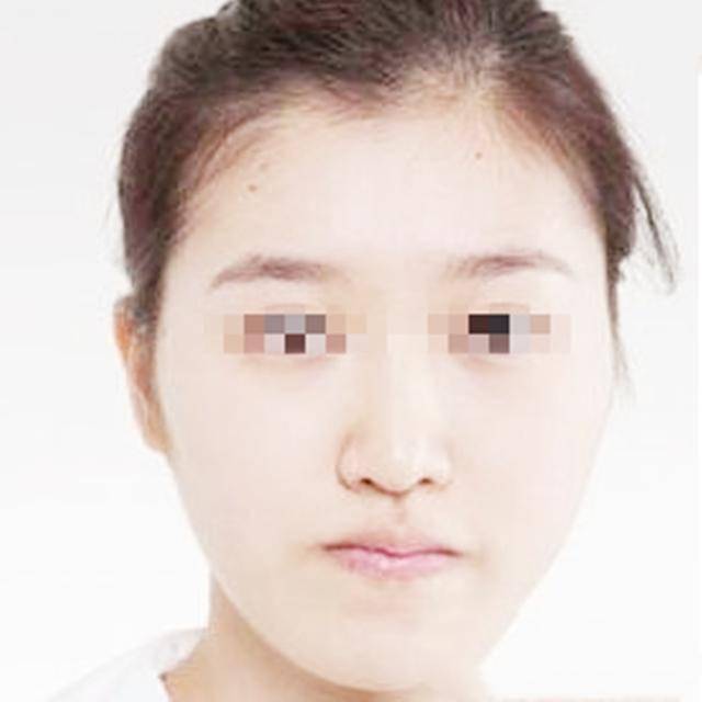 常言道:"男看鼻子女看嘴",面相虽不能影响运势,却能影响颜值