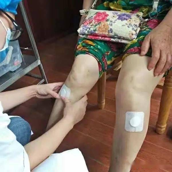 冬病夏治,崇州市中医医院"三伏贴"开贴啦