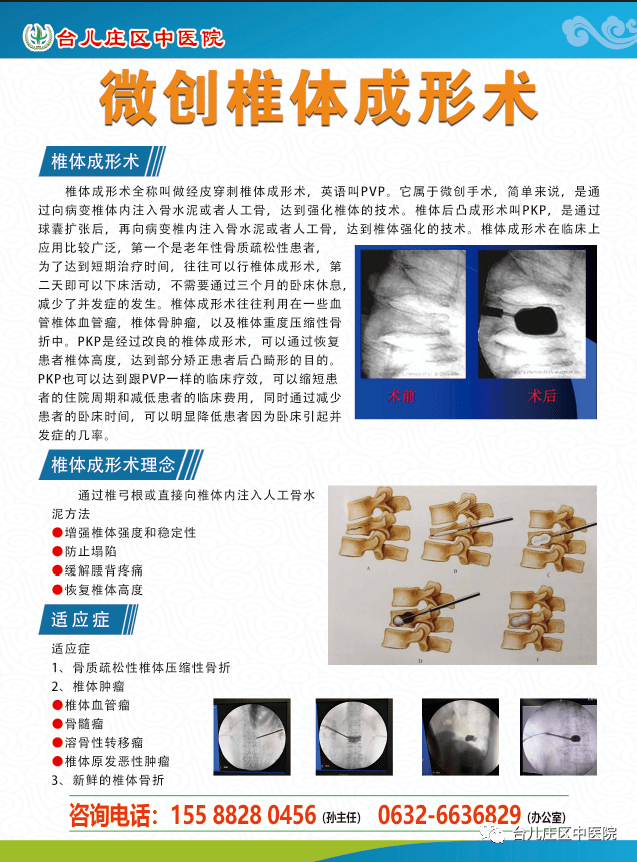 椎间孔镜宣传图片图片